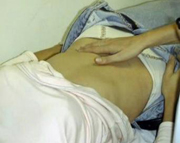 Recordar si sospita mononucleosis infecciosa